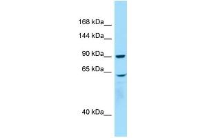 WB Suggested Anti-WHAMM Antibody Titration: 1. (WHAMM anticorps  (C-Term))