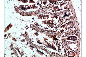 Immunohistochemical analysis of paraffin-embedded human-colon, antibody was diluted at 1:200