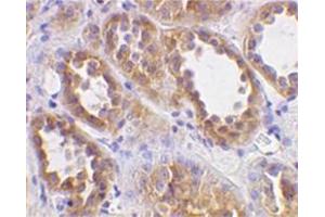 Image no. 1 for anti-Angiotensin I Converting Enzyme 2 (ACE2) (N-Term) antibody (ABIN319091) (ACE2 anticorps  (N-Term))