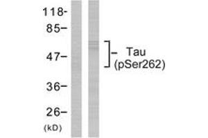 Western Blotting (WB) image for anti-Microtubule-Associated Protein tau (MAPT) (pSer262) antibody (ABIN2888545) (MAPT anticorps  (pSer262))
