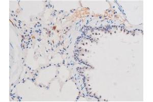 ABIN6267508 at 1/200 staining Rat lung tissue sections by IHC-P. (STAT1 anticorps  (pSer727))