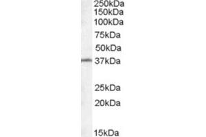 Western Blotting (WB) image for anti-Radial Spoke Head 1 Homolog (RSPH1) (Internal Region) antibody (ABIN2466759)