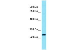Host: Rabbit Target Name: C4orf45 Sample Type: Fetal Lung lysates Antibody Dilution: 1. (C4ORF45 anticorps  (C-Term))