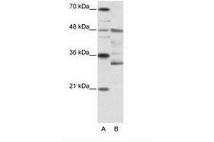 Image no. 1 for anti-Forkhead Box N2 (FOXN2) (N-Term) antibody (ABIN6736146) (FOXN2 anticorps  (N-Term))
