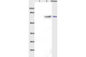 Lane 1: rat brain lysates Lane 2: rat kidney lysates probed with Mouse Anti-AFP(A2) Monoclonal Antibody, Unconjugated (ABIN722901) at 1:200 in 4 °C.