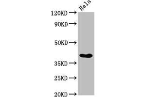 Western Blot Positive WB detected in: Hela whole cell lysate All lanes: NKX2-3 antibody at 3. (NK2 Homeobox 3 anticorps  (AA 52-148))