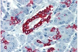 Pancreas, Human: Formalin-Fixed, Paraffin-Embedded (FFPE) (Cytokeratin 19 anticorps  (C-Term))