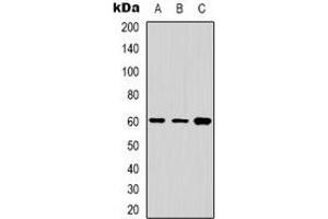 Western blot analysis of Cytochrome P450 24A1 expression in Jurkat (A), A431 (B), HepG2 (C) whole cell lysates.