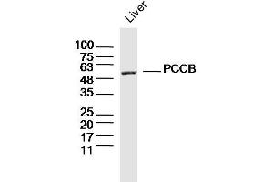 Mouse liver lysates probed with PCCB Polyclonal Antibody, Unconjugated  at 1:300 dilution and 4˚C overnight incubation. (PCCB anticorps  (AA 321-420))