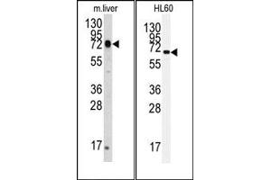 Image no. 1 for anti-Heat Shock 70kDa Protein 5 (Glucose-Regulated Protein, 78kDa) (HSPA5) antibody (ABIN356850) (GRP78 anticorps)