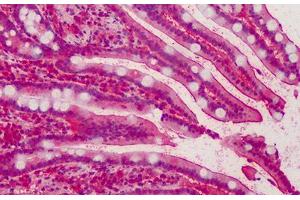 Human Small Intestine: Formalin-Fixed, Paraffin-Embedded (FFPE) (MPP5 anticorps  (AA 174-187))
