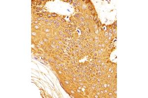 (ABIN6242763 and ABIN6577904) staining SNCA in Human skin tissue sections by Immunohistochemistry (IHC-P - paraformaldehyde-fixed, paraffin-embedded sections). (SNCA anticorps  (C-Term))