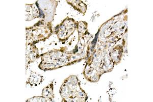 anti-Ubiquitin-Conjugating Enzyme E2L 3 (UBE2L3) antibody