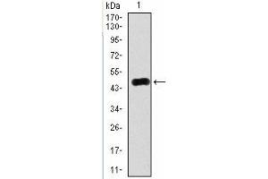 Western Blotting (WB) image for anti-RAB4A, Member RAS Oncogene Family (RAB4A) antibody (ABIN1108812)