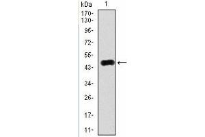 Western Blotting (WB) image for anti-RAB4A, Member RAS Oncogene Family (RAB4A) antibody (ABIN1108812) (Rab4 anticorps)