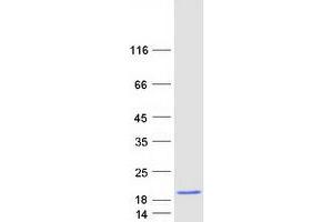 Validation with Western Blot