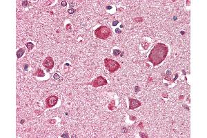 Anti-GABRA6 antibody IHC staining of human brain, cortex. (GABRA6 anticorps  (AA 15-26))