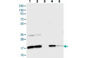 Western blot analysis of Lane 1: RT-4, Lane 2: U-251 MG, Lane 3: Human Plasma, Lane 4: Liver, Lane 5: Tonsil with CNPY2 polyclonal antibody . (CNPY2/MSAP anticorps)