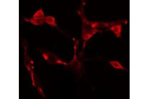 ABIN6274617 staining Hela cells by IF/ICC. (CDCA7 anticorps  (Internal Region))