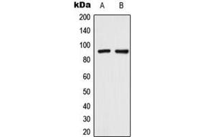 Western blot analysis of TRPV3 expression in HeLa (A), SHSY5Y (B) whole cell lysates. (TRPV3 anticorps  (Center))