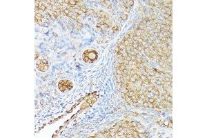 Immunohistochemistry of paraffin-embedded rat ovary using CX3CL1 Rabbit pAb (ABIN6129035, ABIN6139265, ABIN6139266 and ABIN6218481) at dilution of 1:150 (40x lens).