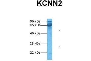 Host:  Rabbit  Target Name:  KCNN2  Sample Tissue:  Human Fetal Liver  Antibody Dilution:  1.