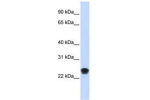 Image no. 1 for anti-FK506 Binding Protein 11, 19 KDa (FKBP11) (AA 35-84) antibody (ABIN6740999) (FKBP11 anticorps  (AA 35-84))