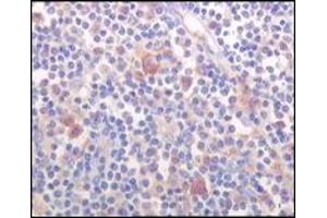 Immunohistochemistry (IHC) image for anti-Bruton Agammaglobulinemia tyrosine Kinase (BTK) (truncated) antibody (ABIN2464023)