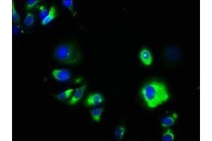 Immunofluorescence staining of MCF-7 cells with ABIN7147319 at 1:133, counter-stained with DAPI. (GPA33 anticorps  (AA 22-235))