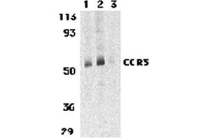 Western Blotting (WB) image for anti-Chemokine (C-C Motif) Receptor 3 (CCR3) (C-Term) antibody (ABIN1030329) (CCR3 anticorps  (C-Term))