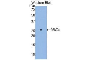 Western Blotting (WB) image for anti-Glutamate-Cysteine Ligase, Catalytic Subunit (GCLC) (AA 429-637) antibody (ABIN1858974) (GCLC anticorps  (AA 429-637))
