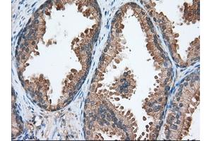 Immunohistochemical staining of paraffin-embedded Human liver tissue using anti-TACC3 mouse monoclonal antibody. (TACC3 anticorps)