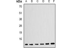 Western blot analysis of GABARAP expression in HepG2 (A), Jurkat (B), PC12 (C), mouse kidney (D), mouse brain (E), rat kidney (F) whole cell lysates. (GABARAP anticorps)