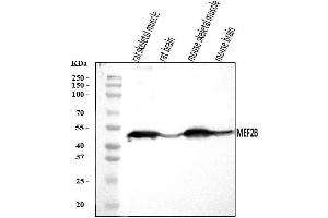 Western blot analysis of MEF2B using anti-MEF2B antibody (ABIN7599892).
