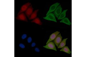 ABIN7096448 and ABIN7100512 staining Hela cells(45 min of heat-shock treatment) by IF/ICC. (TRIM47 anticorps)