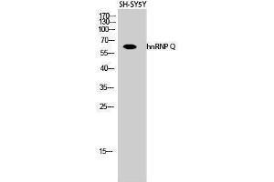 Western Blotting (WB) image for anti-Synaptotagmin Binding, Cytoplasmic RNA Interacting Protein (SYNCRIP) (Internal Region) antibody (ABIN3185069) (SYNCRIP anticorps  (Internal Region))