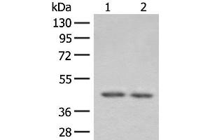 Western blot analysis of 293T cell lysates using ILKAP Polyclonal Antibody at dilution of 1:800 (ILKAP anticorps)