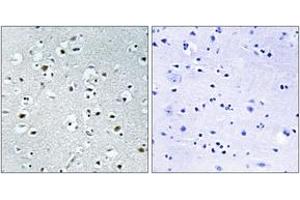 Immunohistochemistry analysis of paraffin-embedded human brain tissue, using PPRC1 Antibody. (PPRC1 anticorps  (AA 1609-1658))
