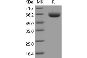 Western Blotting (WB) image for Beta-secretase 1 (BACE1) (Active) protein (His tag) (ABIN7320444)