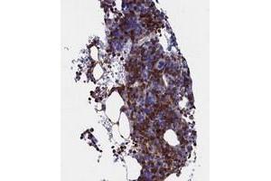 Immunohistochemical staining of human bone marrow with TYROBP polyclonal antibody  shows strong cytoplasmic positivity in hematopoietic cells. (TYROBP anticorps)