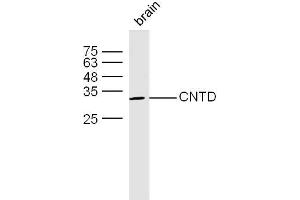 Mouse bone lysates probed with CNTD Polyclonal Antibody, unconjugated  at 1:300 overnight at 4°C followed by a conjugated secondary antibody at 1:10000 for 60 minutes at 37°C. (CNTD1 anticorps)