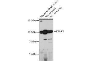 Western blot analysis of extracts of various cell lines, using K antibody (ABIN7268147) at 1:1000 dilution. (KANK2 anticorps  (AA 1-300))