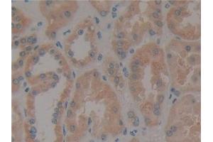 Detection of PXN in Human Kidney Tissue using Polyclonal Antibody to Paxillin (PXN)