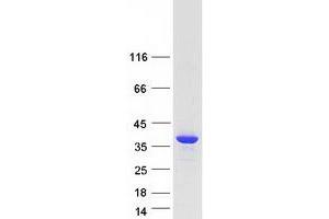 Validation with Western Blot