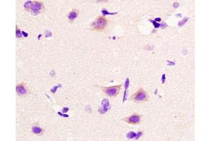Formalin-fixed and paraffin embedded rat brain tissue labeled with Anti-Beta catenin Polyclonal Antibody, Unconjugated at 1:200 followed by conjugation to the secondary antibody,