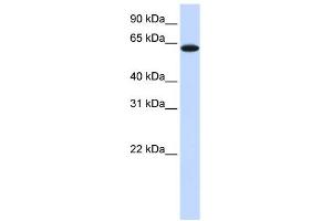 TYRP1 antibody used at 1 ug/ml to detect target protein. (Tyrosinase-Related Protein 1 anticorps  (Middle Region))
