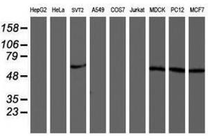 Image no. 1 for anti-V-Akt Murine Thymoma Viral Oncogene Homolog 1 (AKT1) antibody (ABIN1496559) (AKT1 anticorps)