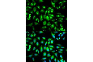 Immunofluorescence analysis of MCF-7 cells using CHRM2 antibody (ABIN5970748). (Muscarinic Acetylcholine Receptor M2 anticorps)