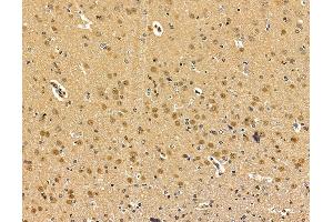 ABIN7095973 and ABIN7100035 at 1/100 staining rat brain tissue by IHC-P.