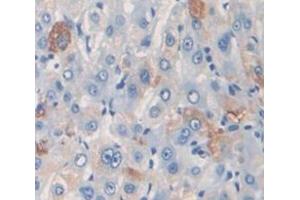 Used in DAB staining on fromalin fixed paraffin- embedded Kidney tissue (PZP anticorps  (AA 1246-1495))